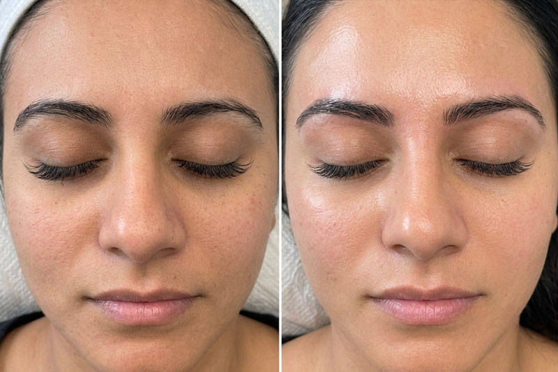 Precision Brow Waxing